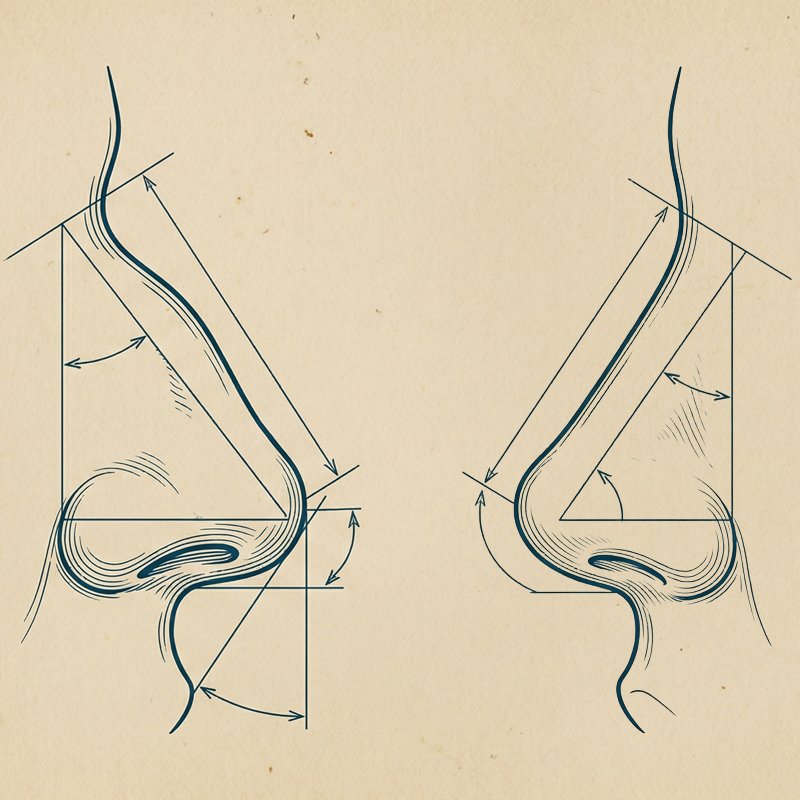 Rinoplasti (Burun Estetiği)
